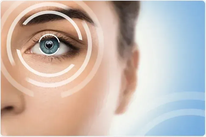 LASIK eye surgery